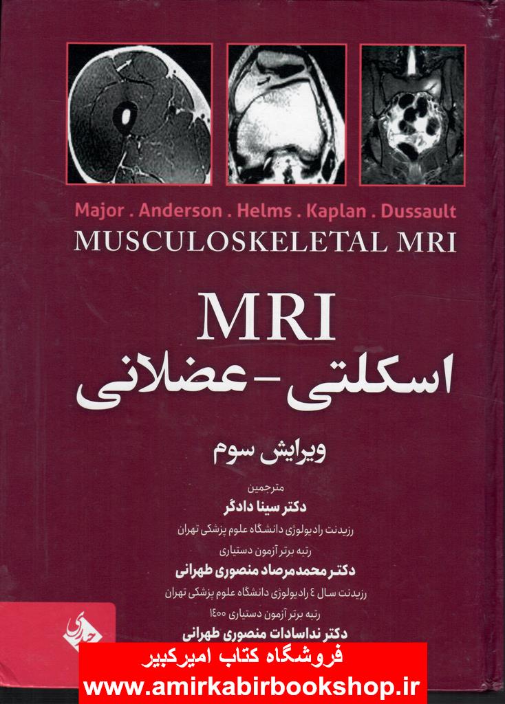 MRI اسکلتي-عضلاني